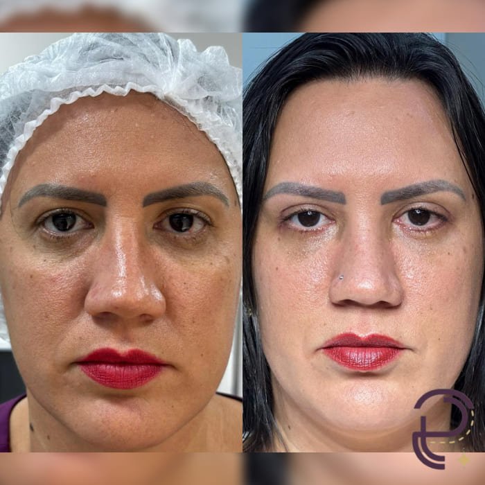 Antes e depois 10